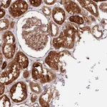 Atlas Antibodies Anti-PPP1R21 Antibody