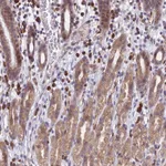 Atlas Antibodies Anti-PPP1R26 Antibody