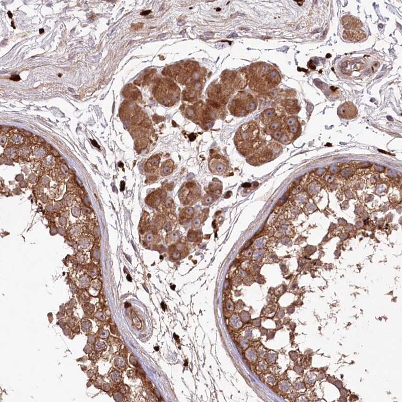 Atlas Antibodies Anti-PPP1R21 Antibody