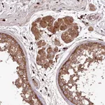 Atlas Antibodies Anti-PPP1R21 Antibody