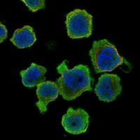 Atlas Antibodies Anti-PPP1R27 Antibody