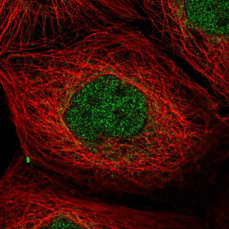 Atlas Antibodies Anti-PPP1R2 Antibody