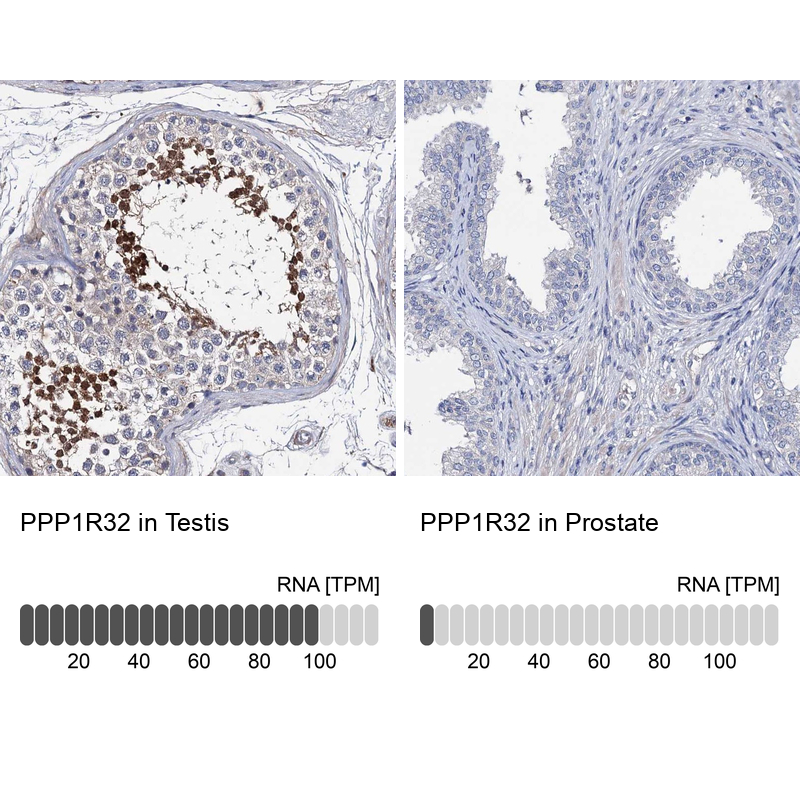 Atlas Antibodies Anti-PPP1R32 Antibody
