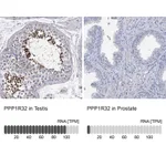 Atlas Antibodies Anti-PPP1R32 Antibody