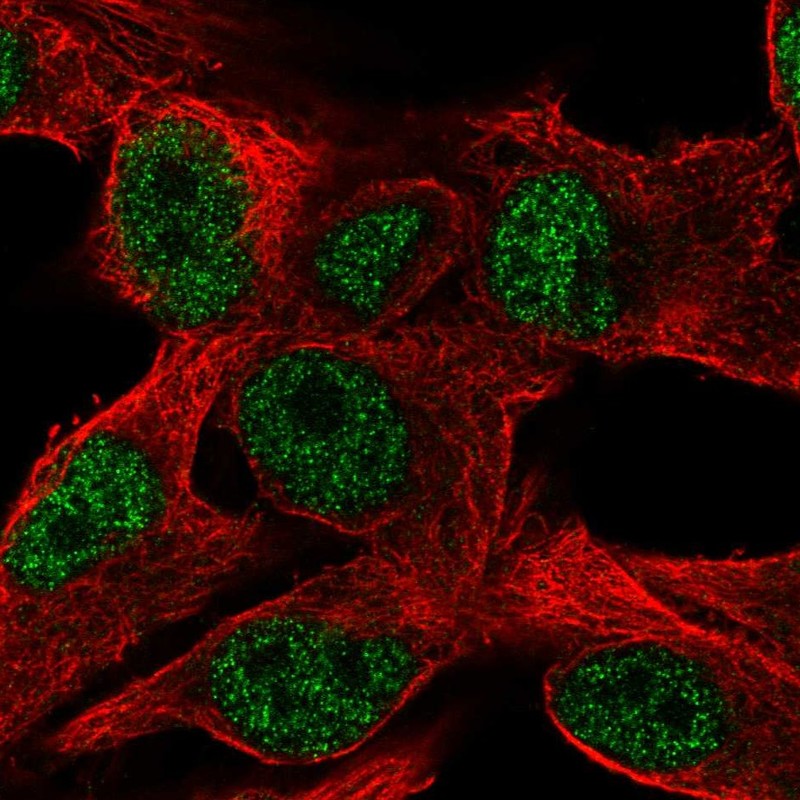 Atlas Antibodies Anti-PPP1R35 Antibody