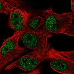 Atlas Antibodies Anti-PPP1R35 Antibody