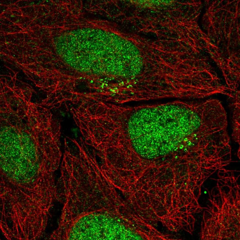 Atlas Antibodies Anti-PPP1R1C Antibody
