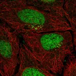 Atlas Antibodies Anti-PPP1R1C Antibody