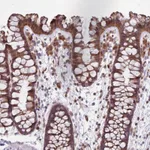 Atlas Antibodies Anti-PPP1R27 Antibody