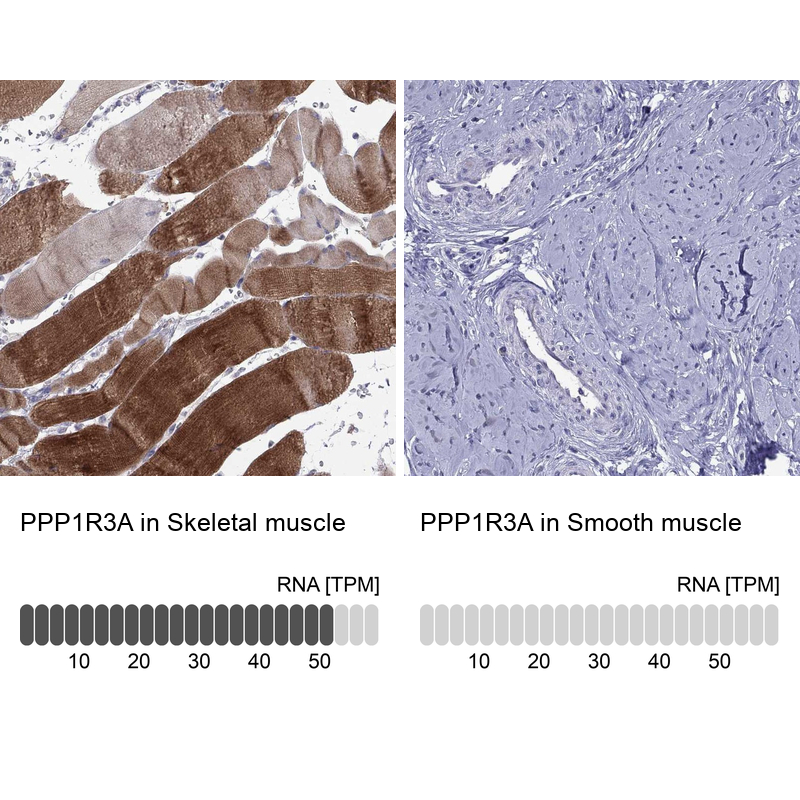 Atlas Antibodies Anti-PPP1R3A Antibody
