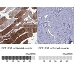Atlas Antibodies Anti-PPP1R3A Antibody