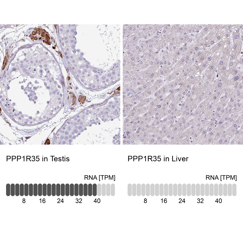 Atlas Antibodies Anti-PPP1R35 Antibody