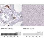 Atlas Antibodies Anti-PPP1R35 Antibody