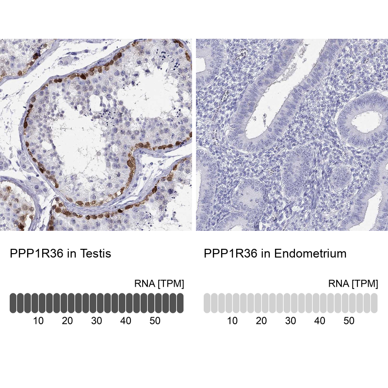 Atlas Antibodies Anti-PPP1R36 Antibody