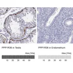 Atlas Antibodies Anti-PPP1R36 Antibody