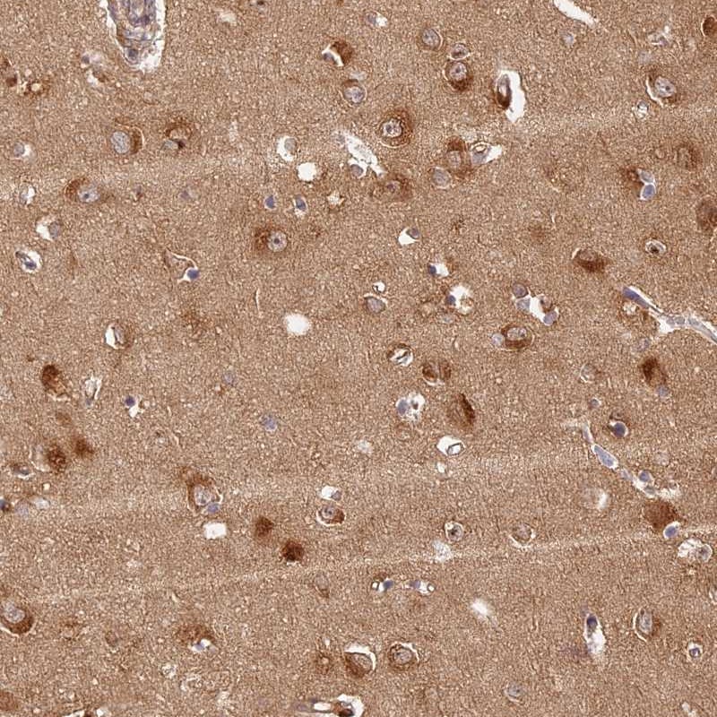 Atlas Antibodies Anti-PPP1R37 Antibody