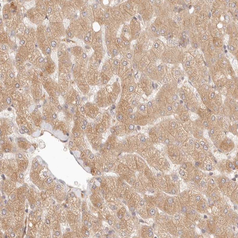 Atlas Antibodies Anti-PPP1R3B Antibody