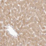 Atlas Antibodies Anti-PPP1R3B Antibody