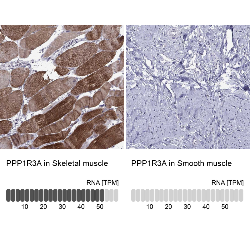 Atlas Antibodies Anti-PPP1R3A Antibody