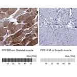 Atlas Antibodies Anti-PPP1R3A Antibody