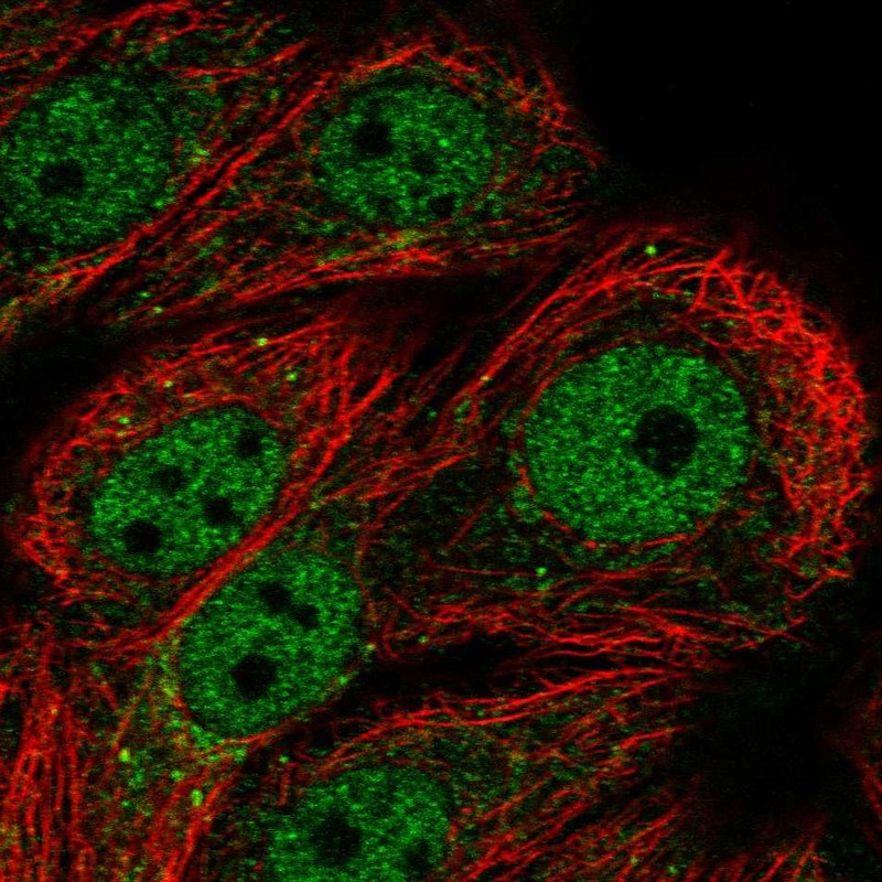Atlas Antibodies Anti-PPP1R3F Antibody