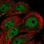 Atlas Antibodies Anti-PPP1R3F Antibody