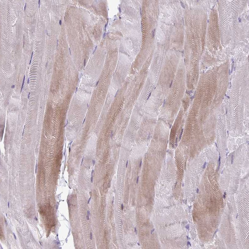 Atlas Antibodies Anti-PPP1R3E Antibody