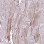 Atlas Antibodies Anti-PPP1R3E Antibody