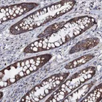 Atlas Antibodies Anti-PPP1R3D Antibody