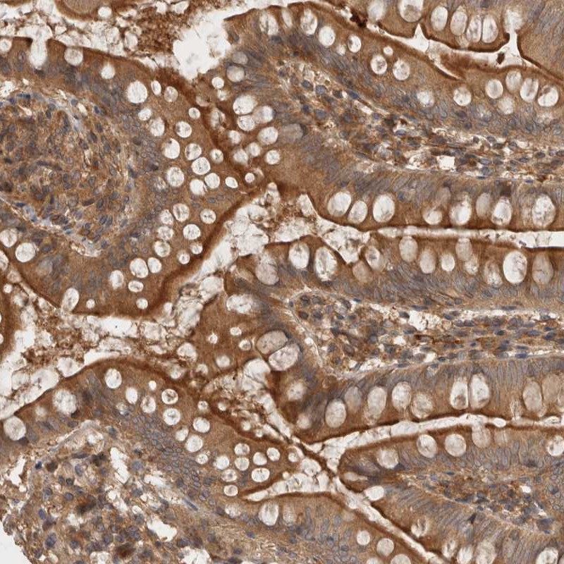 Atlas Antibodies Anti-PPP1R42 Antibody