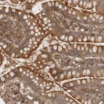 Atlas Antibodies Anti-PPP1R42 Antibody