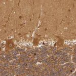 Atlas Antibodies Anti-PPP1R3F Antibody