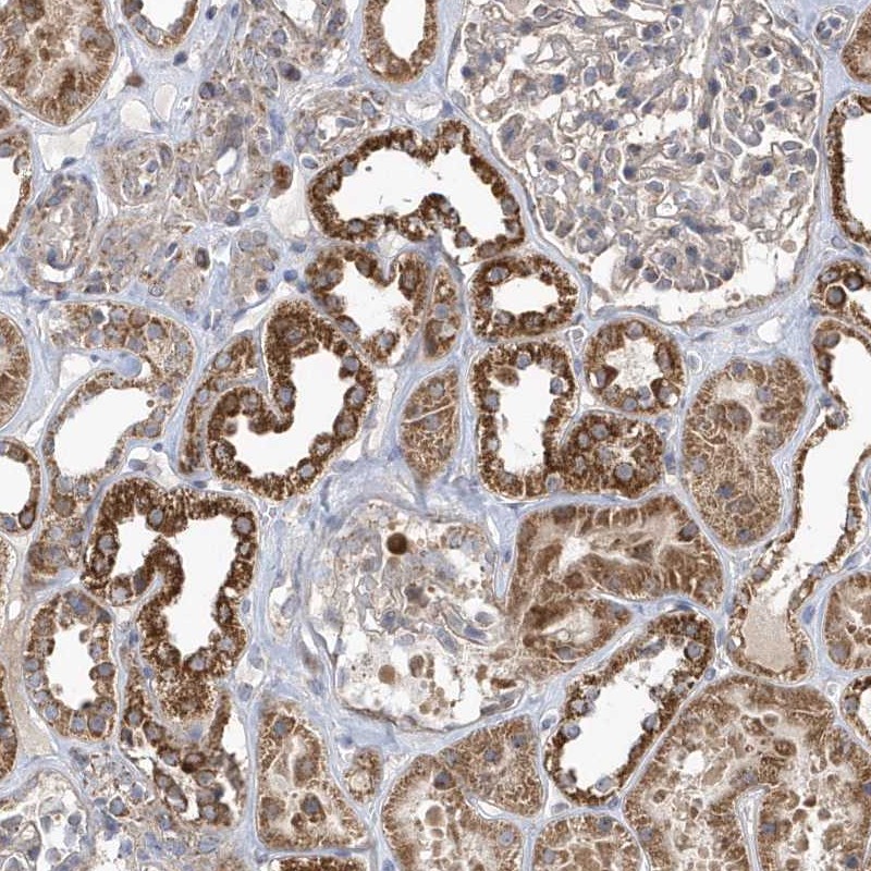 Atlas Antibodies Anti-PPP1R7 Antibody