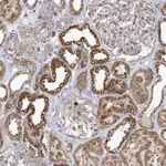 Atlas Antibodies Anti-PPP1R7 Antibody