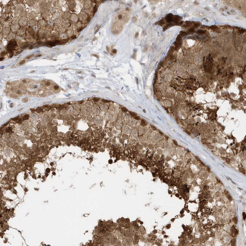 Atlas Antibodies Anti-PPP1R7 Antibody