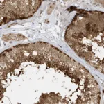 Atlas Antibodies Anti-PPP1R7 Antibody