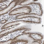 Atlas Antibodies Anti-PPP1R42 Antibody