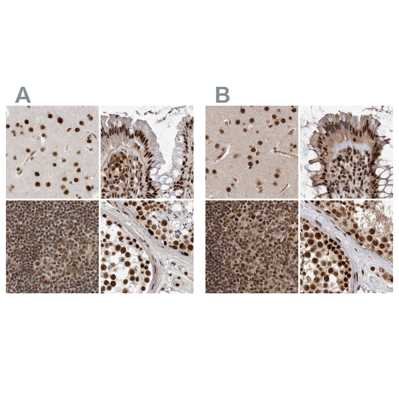 Atlas Antibodies Anti-PPP1R8 Antibody