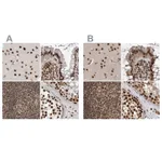 Atlas Antibodies Anti-PPP1R8 Antibody