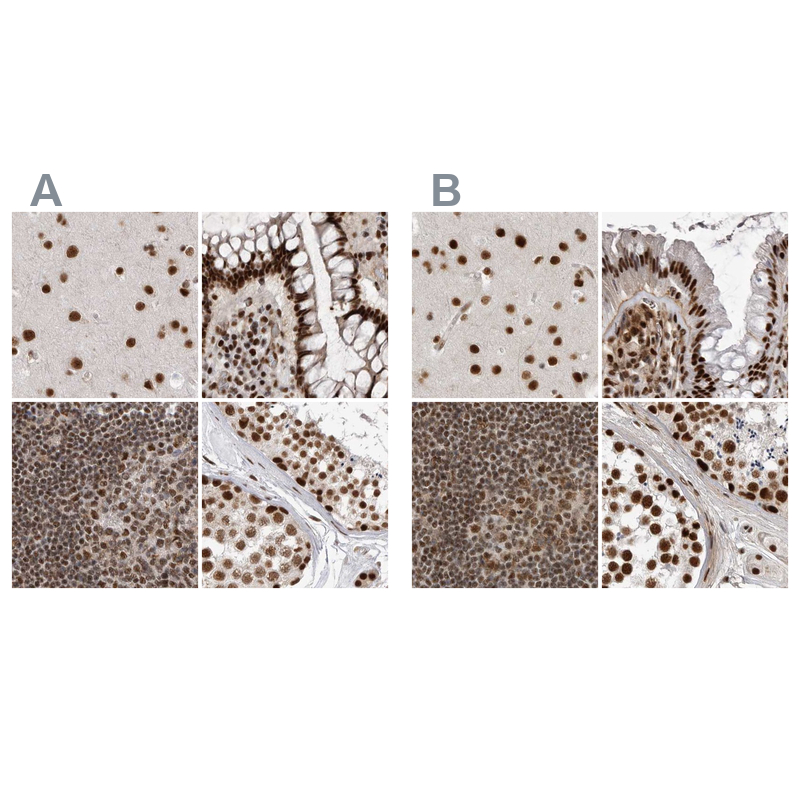 Atlas Antibodies Anti-PPP1R8 Antibody