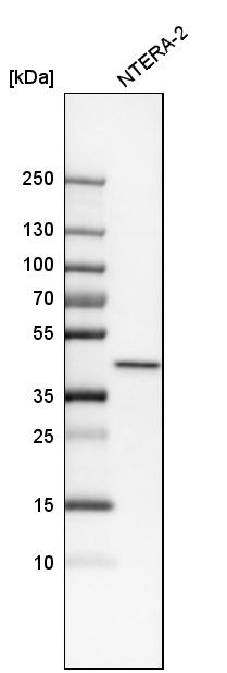 Atlas Antibodies Anti-PPP1R8 Antibody