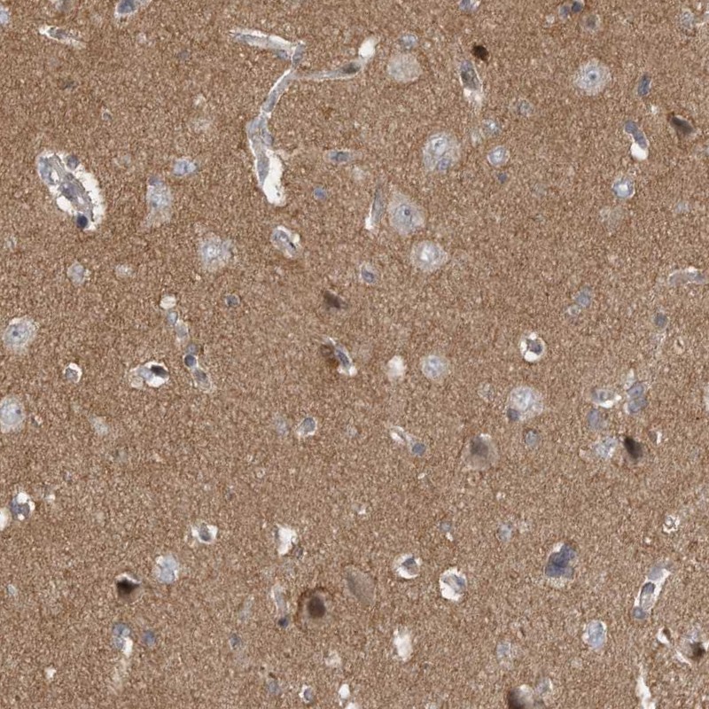 Atlas Antibodies Anti-PPP1R9A Antibody