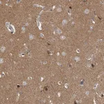 Atlas Antibodies Anti-PPP1R9A Antibody