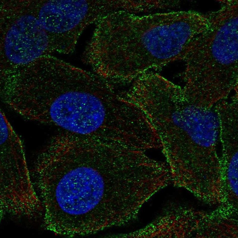 Atlas Antibodies Anti-PPP1R9A Antibody