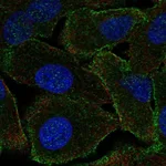 Atlas Antibodies Anti-PPP1R9A Antibody