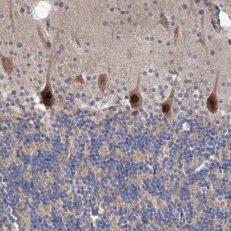 Atlas Antibodies Anti-PPP2R2B Antibody