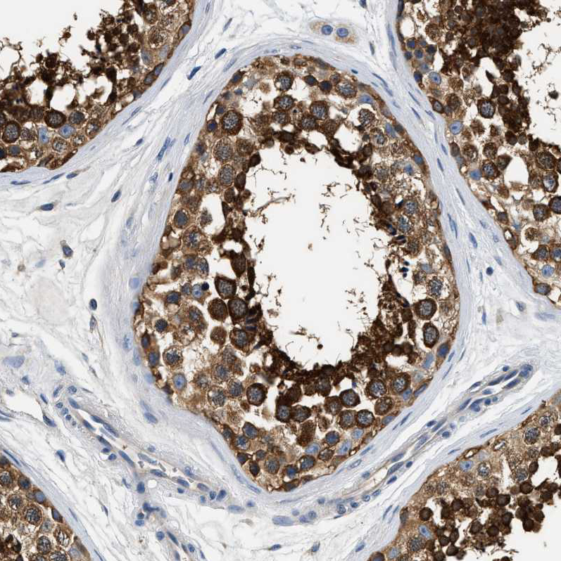 Atlas Antibodies Anti-PPP2R1B Antibody