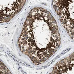 Atlas Antibodies Anti-PPP2R1B Antibody