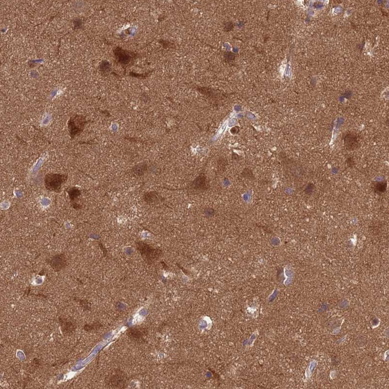 Atlas Antibodies Anti-PPP2CA Antibody