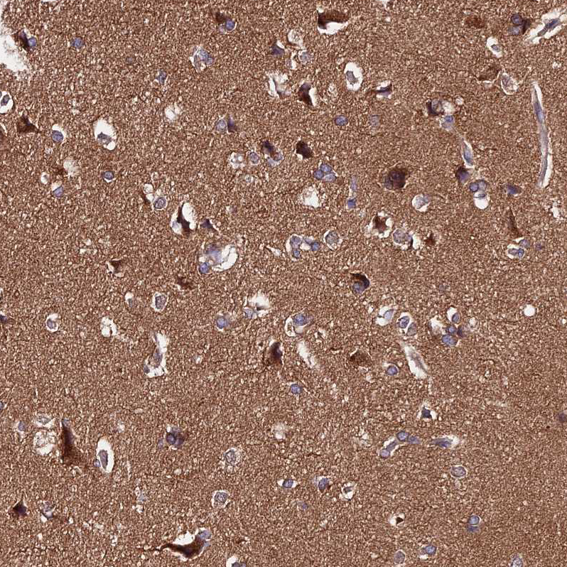 Atlas Antibodies Anti-PPP2R2B Antibody